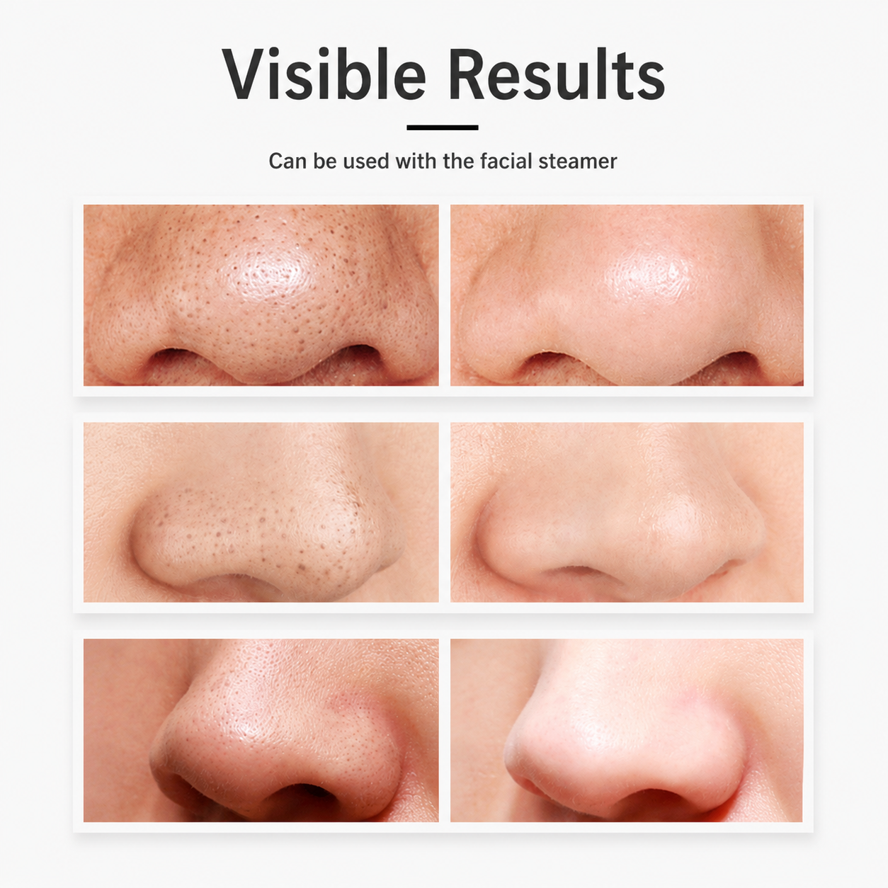 Rechargeable Deep Clean Pore Vacuum